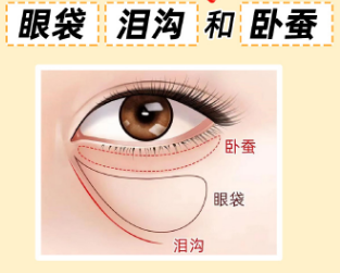 眼袋