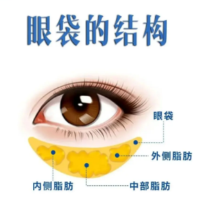 眼袋
