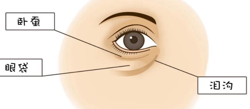 去眼袋手术
