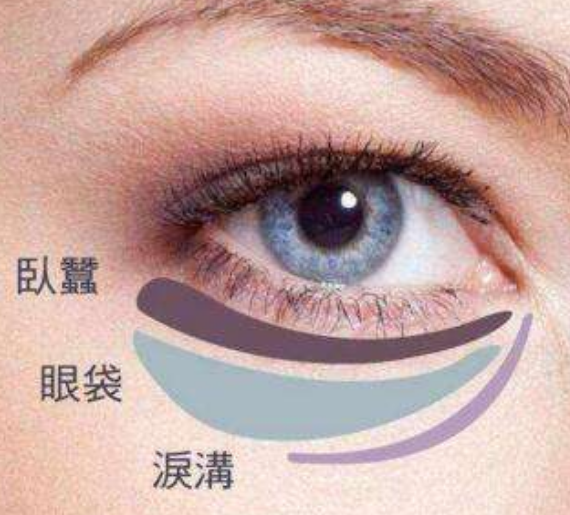 去眼袋手术