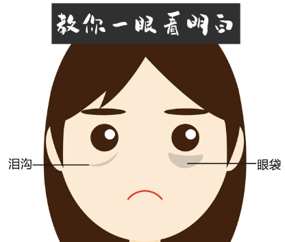 去眼袋手术