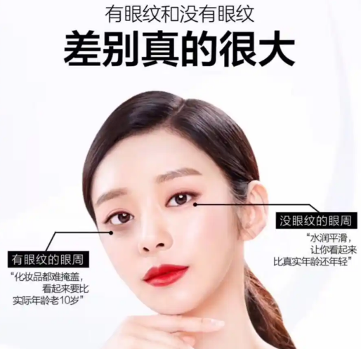 眼袋