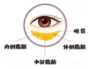 眼袋