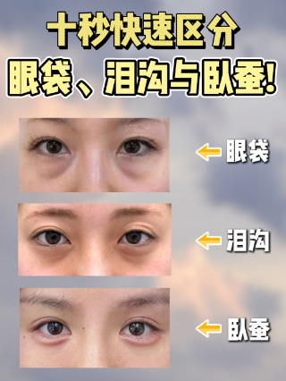 眼袋