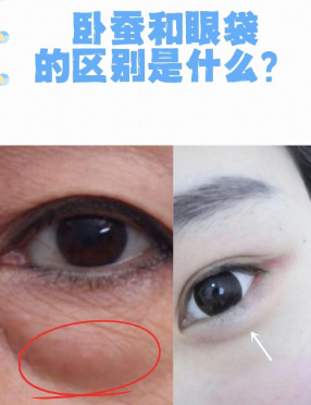 眼袋