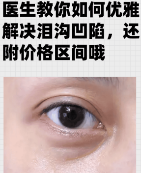 眼袋