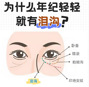 眼袋
