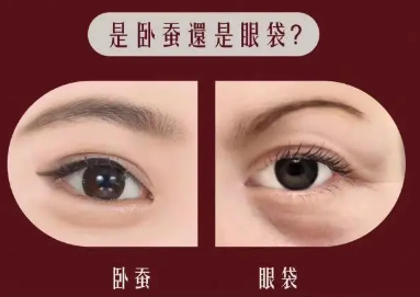眼袋