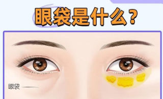 眼袋