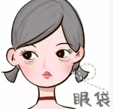 去眼袋手术