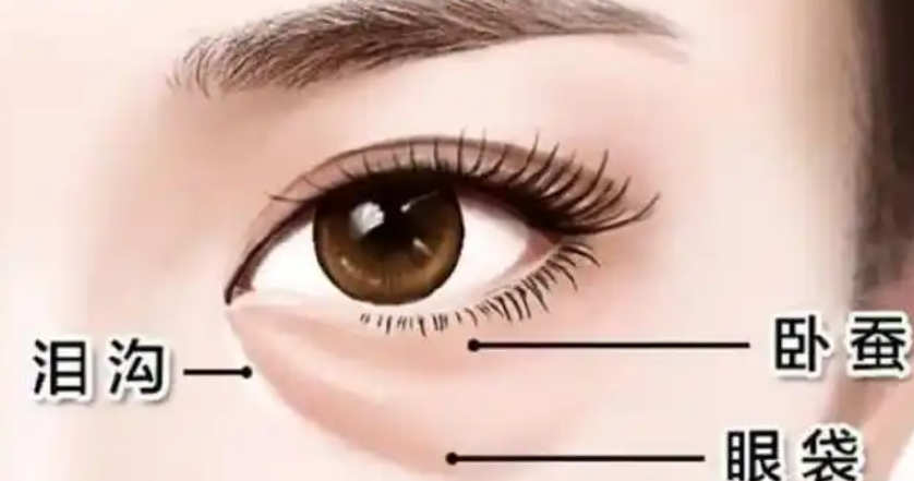 眼袋