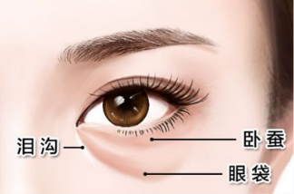 眼袋