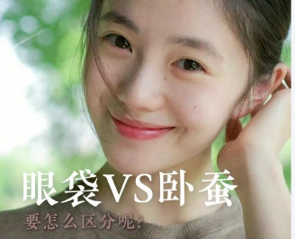 眼袋