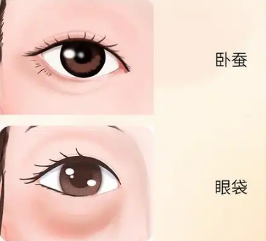 眼袋