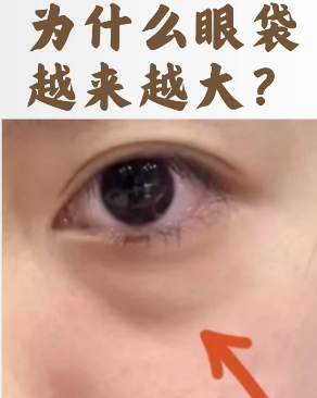 去眼袋手术