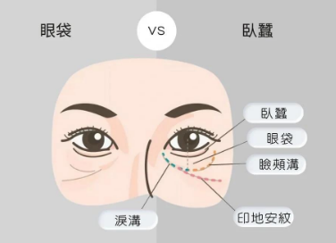眼袋