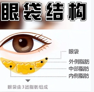 眼袋