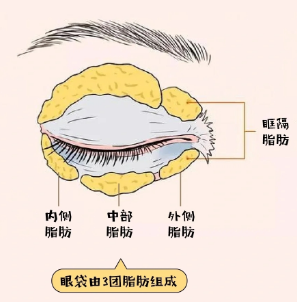眼袋