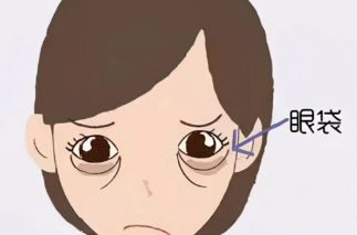 眼袋