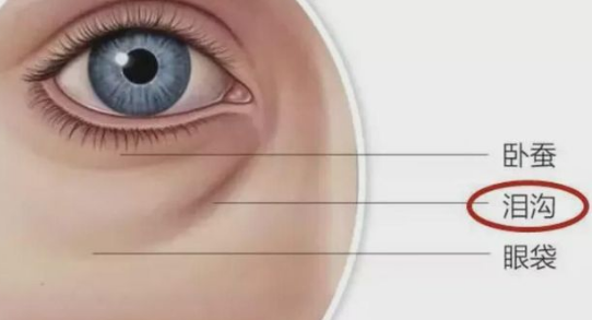眼袋