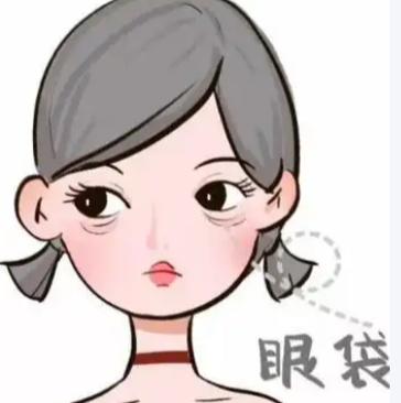 去眼袋手术