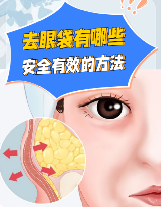 去眼袋手术