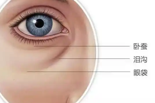 眼袋