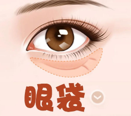去眼袋手术