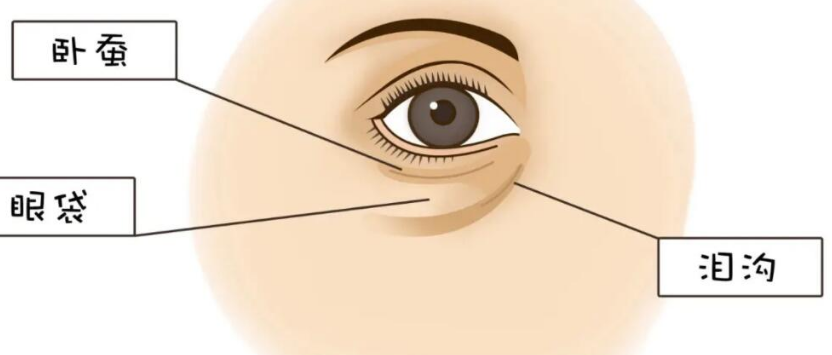 去眼袋手术