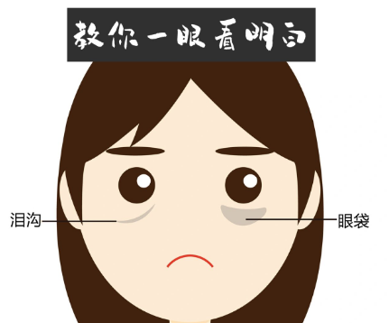 去眼袋手术