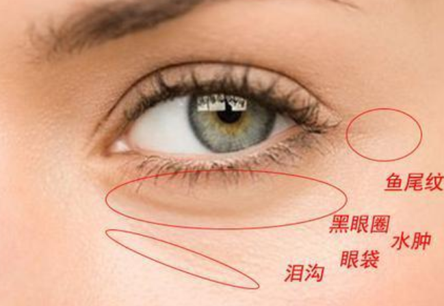 去眼袋手术