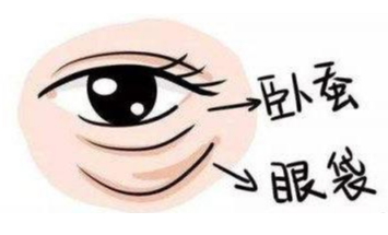 去眼袋手术