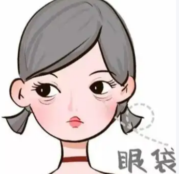 去眼袋手术