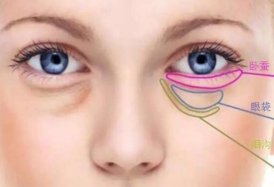 眼袋