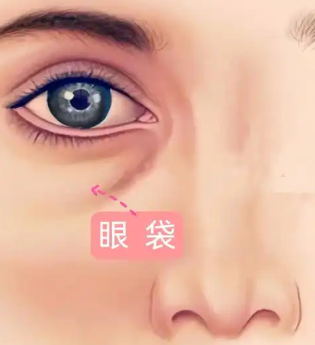 眼袋