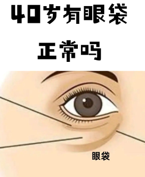 眼袋