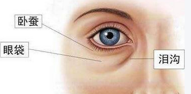 眼袋