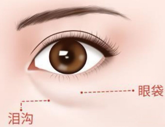 眼袋