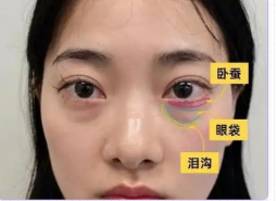 眼袋