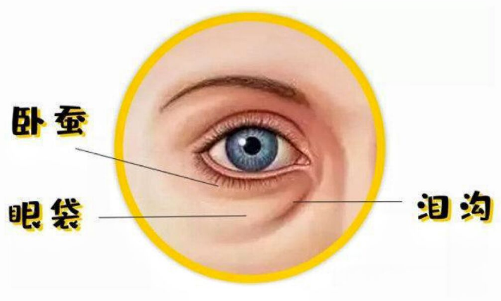 眼袋