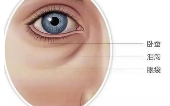 去眼袋手术