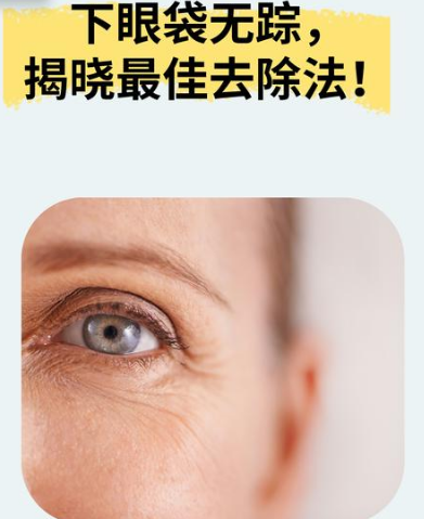 眼袋