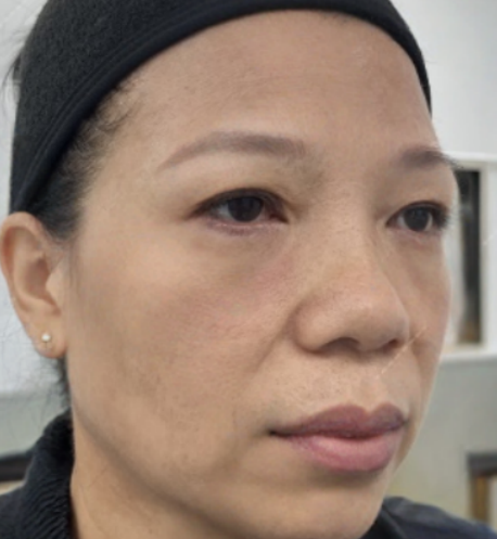 ȥ�۴�����