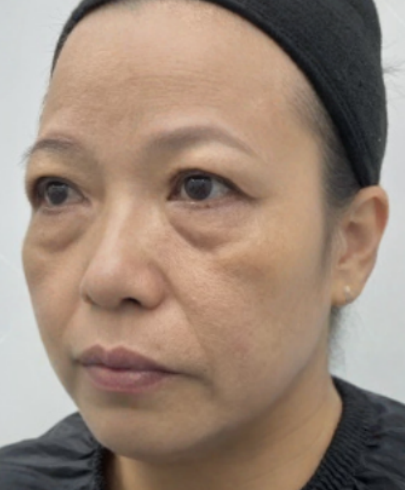 ȥ�۴�����