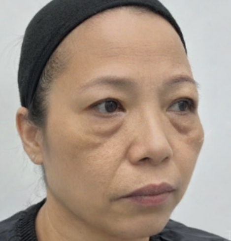 ȥ�۴�����