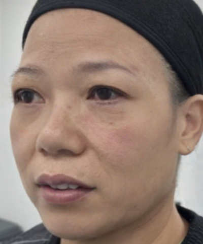 ȥ�۴�����