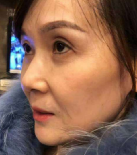 ȥ�۴�����