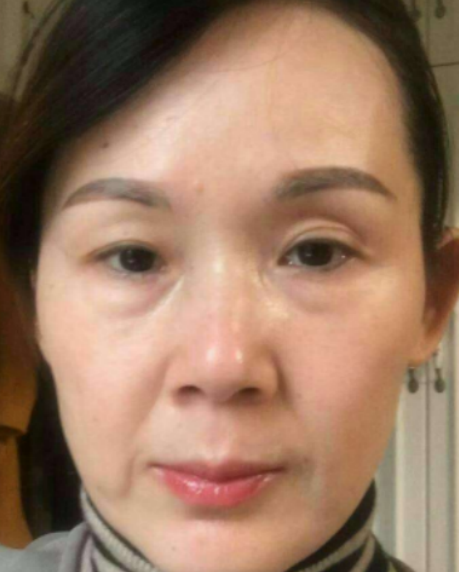 ȥ�۴�����