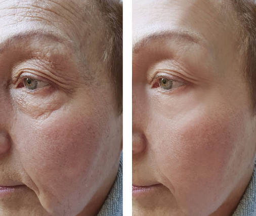 ȥ�۴�����