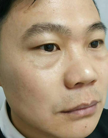 ȥ�۴�����